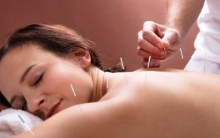 Woman enjoying a Acupuncture Treatment