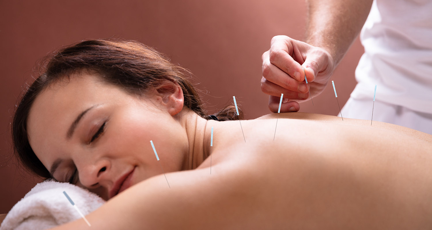 Woman enjoying a Acupuncture Treatment